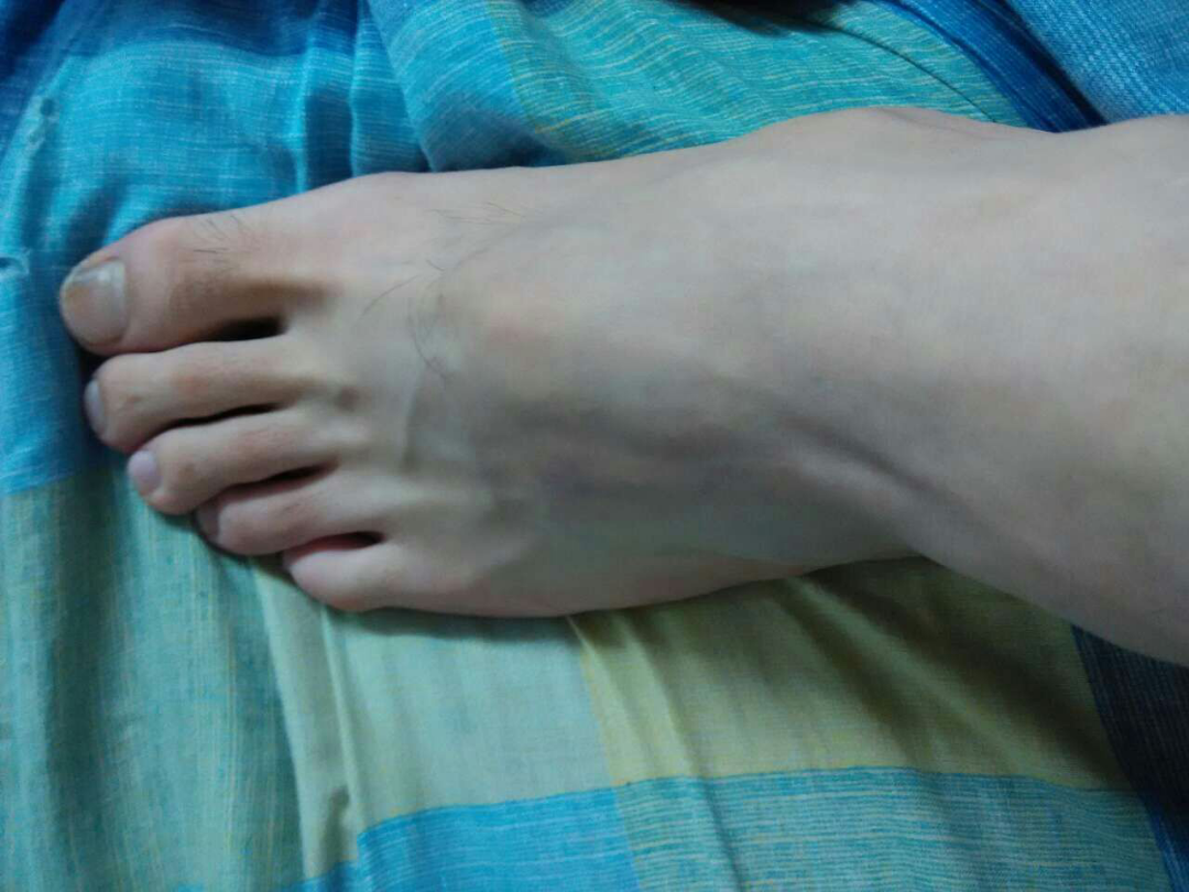 哪些篮球鞋适合脚宽的人? - 松松无数字的回答