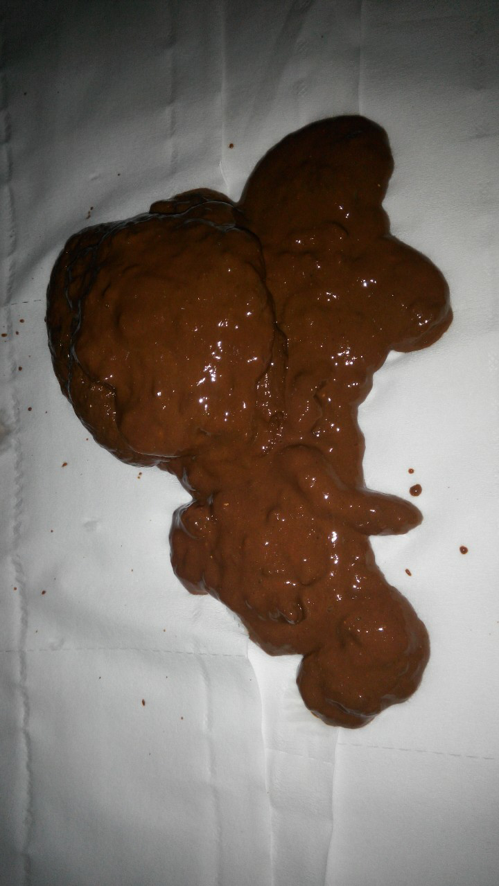 除了化验,如何通过肉眼判断已经胃出血了?