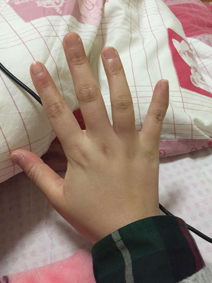 手指短而圆是一种怎样的体验