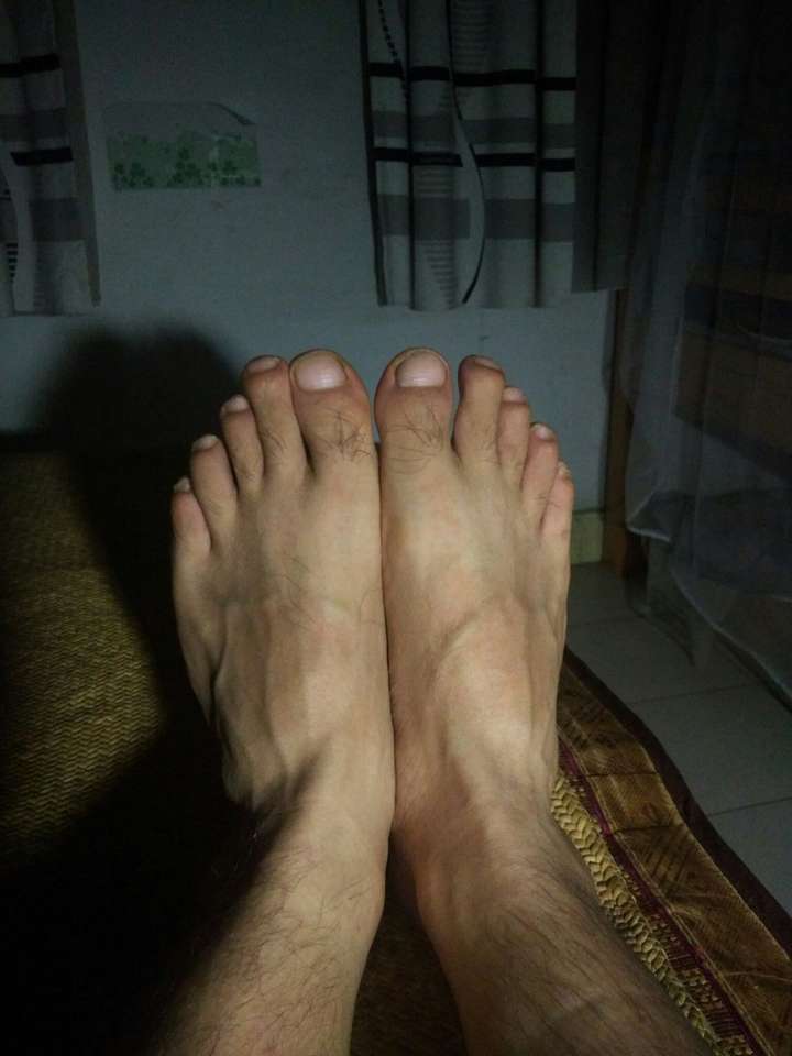 大脚趾大而且圆?