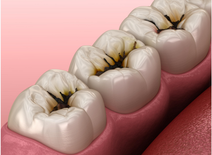 牙痛是什么原因引起的？