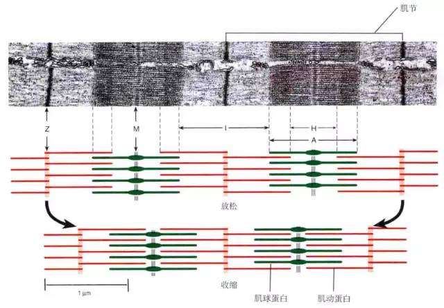 肌力和肌张力的本质区别如何区分