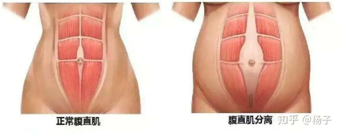 产后如何减下去小肚子 知乎