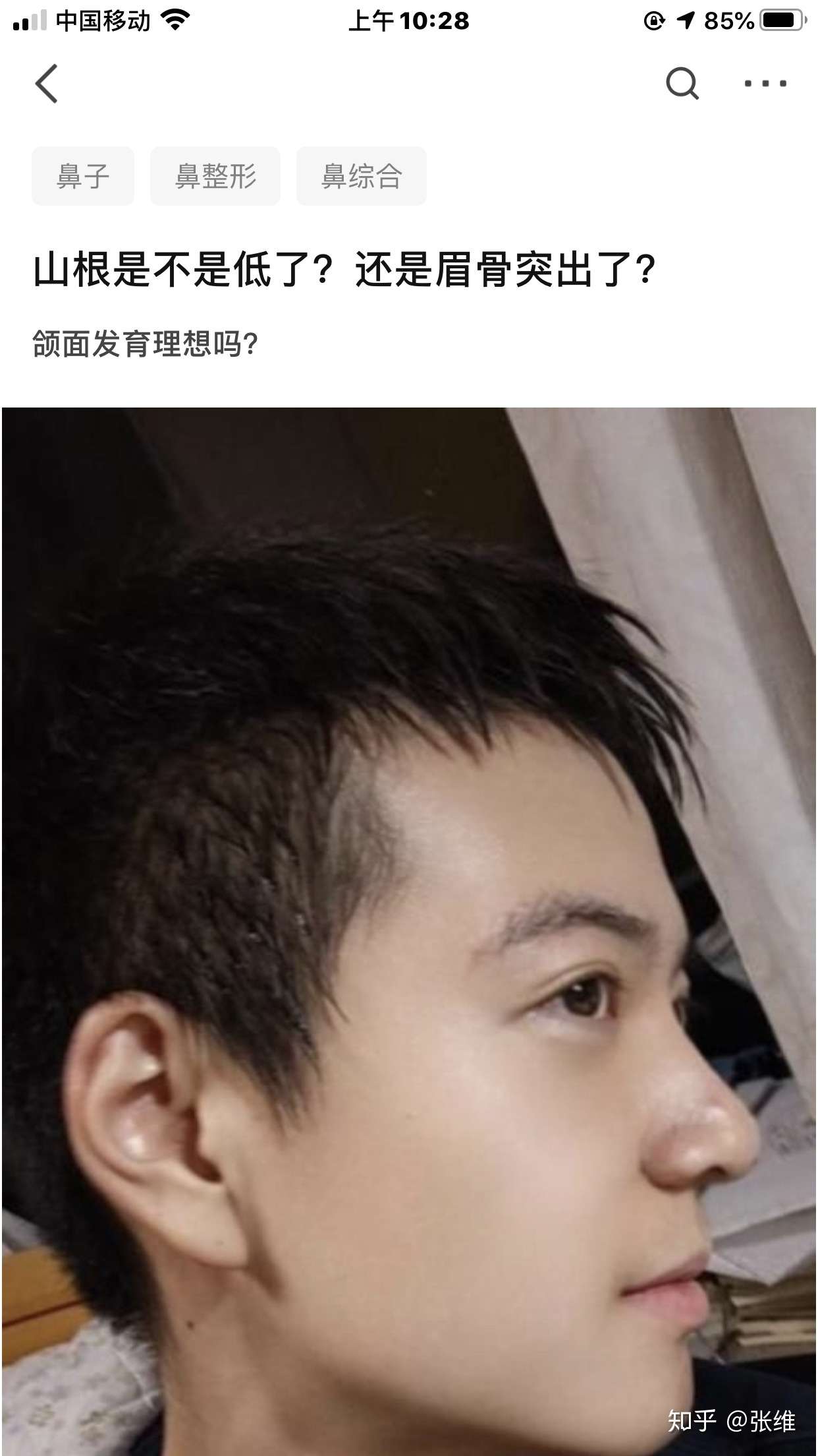 如何判断山根低还是眉骨高呢 知乎