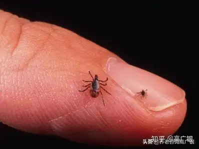 七八十年代人身上的虱子是怎么来的?