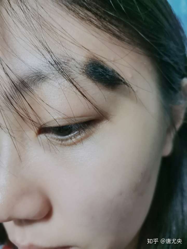 你见过什么特殊的胎记?