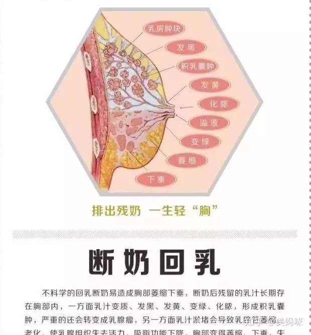 断奶后一定要排出残留乳 千万别拿自己的乳房做赌注 知乎