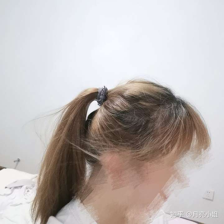 请大家帮我看看我这算哪种程度的扁头