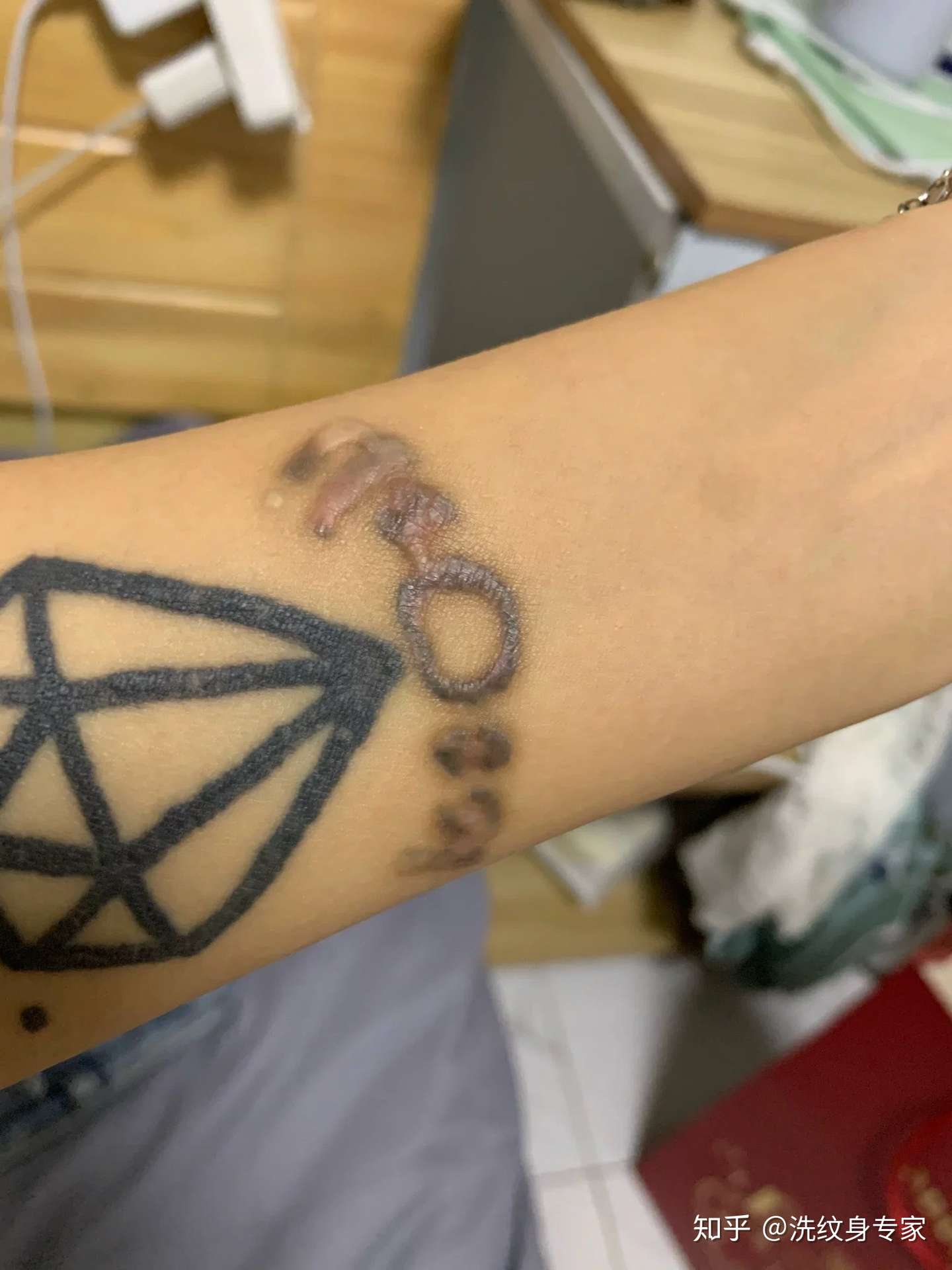 洗纹身技术总结经验分享给大家 知乎