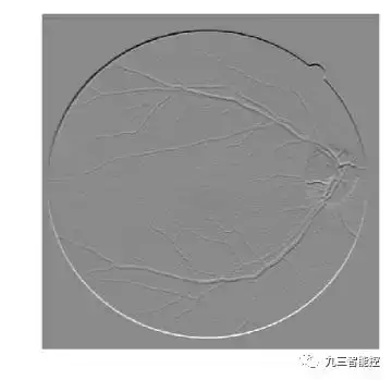算法集锦(5)|医学图像的边缘检测|Python_边缘检测方法分割医学图像图-CSDN博客