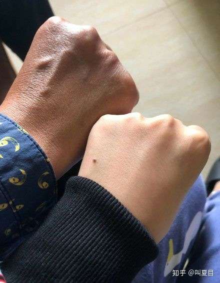 怎样可以变白呢我是手白胳膊黑附图一张求解决吧
