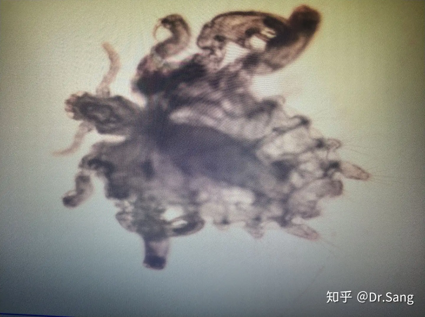 阴虱，你又回来了？ - 知乎