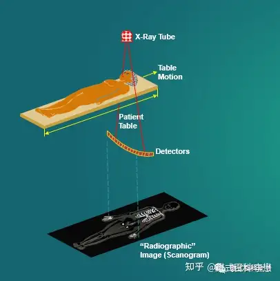 ct的定位像扫描中x线球管和探测器静止,扫描床移动,得到一个大范围的