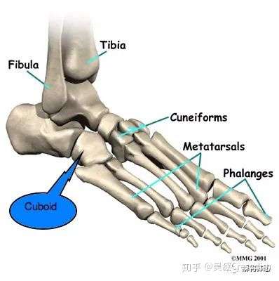 中足外侧痛的常见原因 骰骨错位 力学分析与康复 知乎