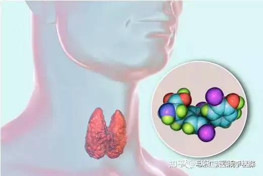 中医解读甲状腺结节、甲亢、甲减，弄懂这些，治疗起来事半功倍（甲状腺结节的中医辩证论治好大夫）