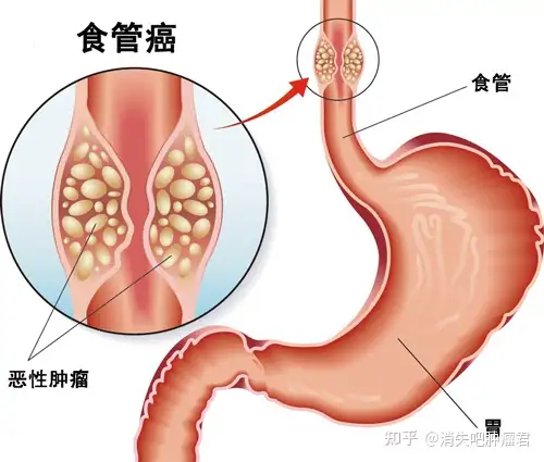 妻炸羔客并深？荧摄删应尔曾什唐检查？(图2)