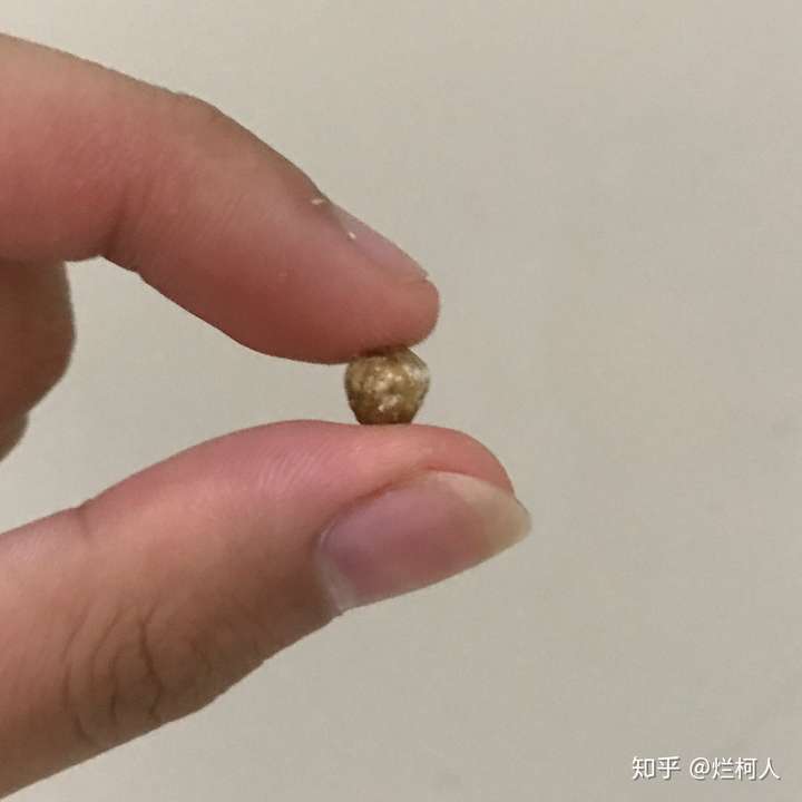 鸡腿肾结石图片图片