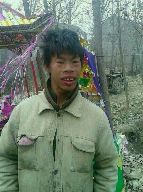 假如黑人从小就接受正规教育,在正常的环境下成长,与其他种族会有区别