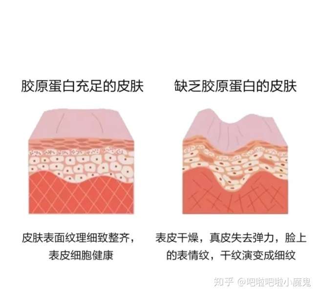 抗衰老 皮肤老化的原因 延缓皮肤老化要做好防晒 知乎