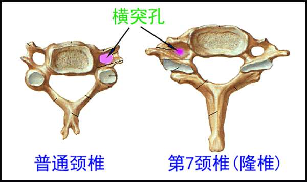 隆椎解剖图图片