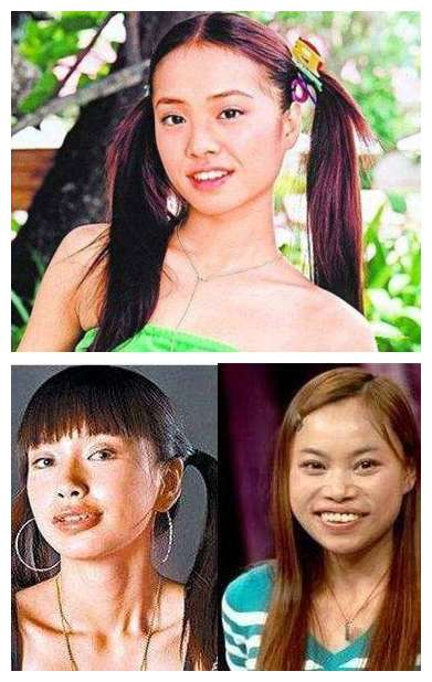 嘴巴难看是一种怎样的体验