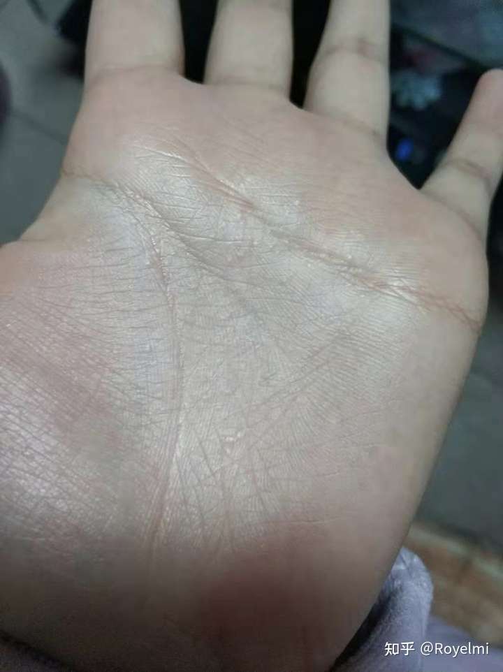 小龙坎火锅被曝用发芽发黑土豆,菌菇青菜类食材不清