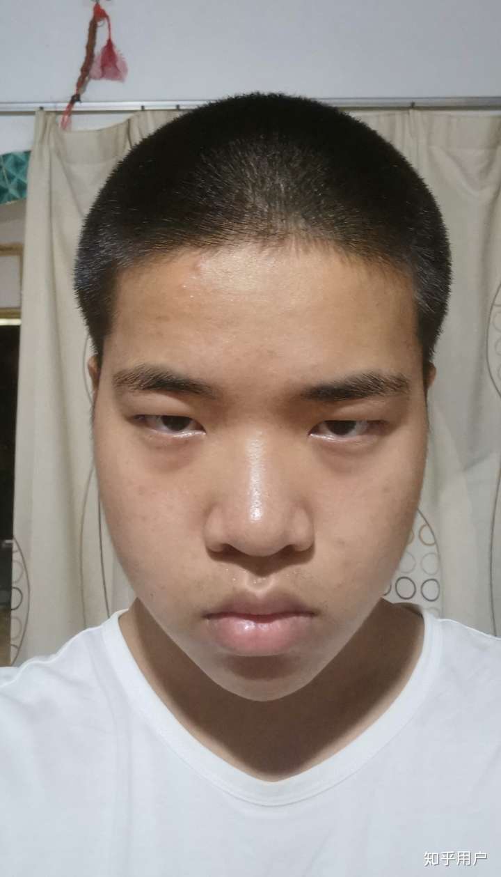 脸很长是什么体验?