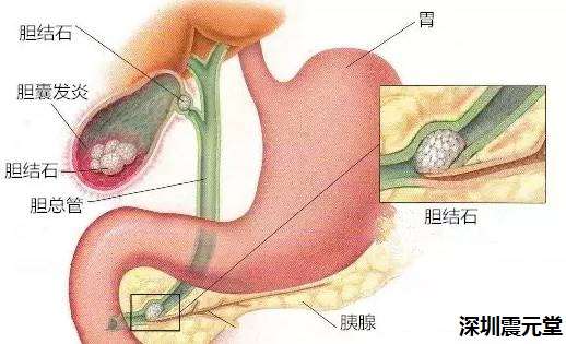 震元堂推荐 这三种病都是自己 作 出来的 知乎
