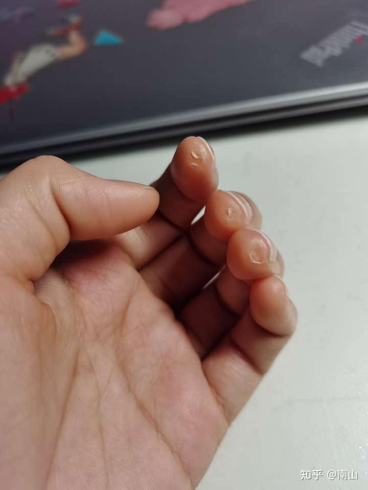 玩吉他的朋友可以拍一张左手手指上的茧吗?