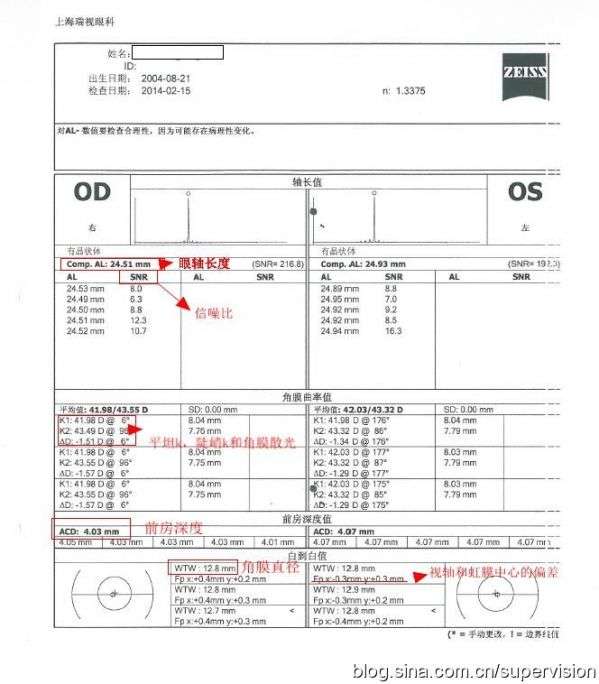 怎么看角膜地形图上的数据