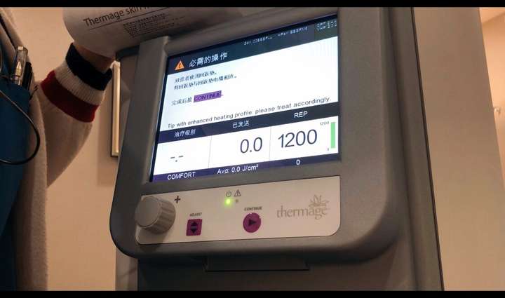 医美的效果强大到真的会上瘾(图41) 医美的效果强大到真的会上瘾(图44)