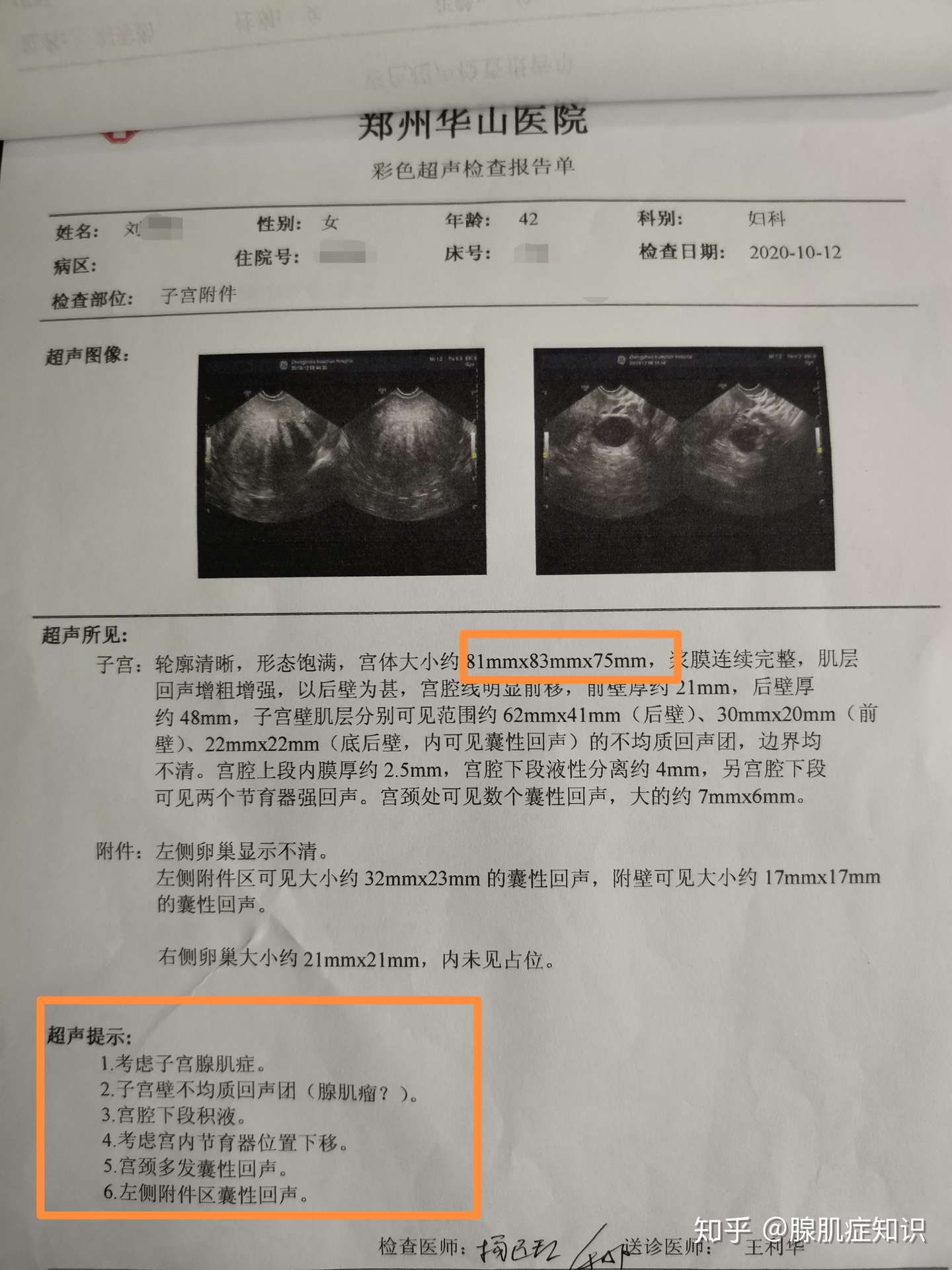 教你从彩超单子上判断 是否得了子宫腺肌症 知乎