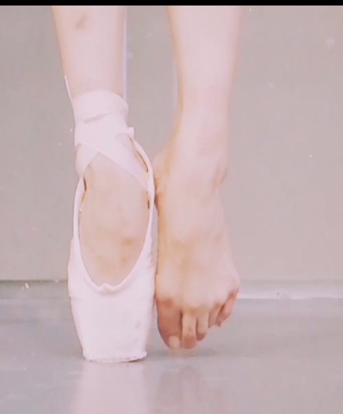 芭蕾舞演员的脚会变成什么样?