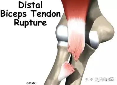 肱二头肌 (bicep brachii muscle)