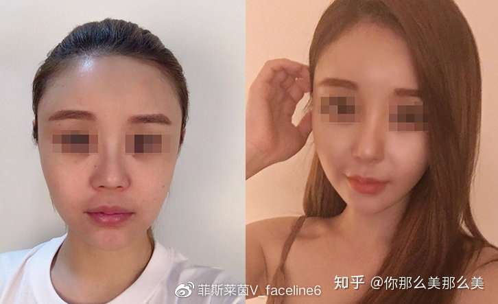 韩国整形美容哪家比较好 知乎