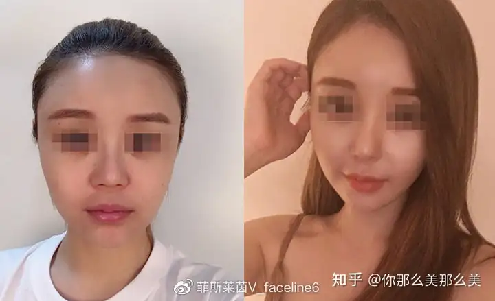 韩国整形美容哪家比较好?丨韩国美容整形医院排行榜?