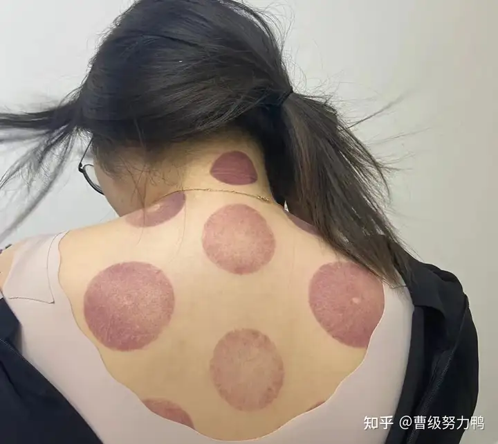 正常吃饭，每天半个小时的刘畊宏锻炼，短时间内甩肉成功，我是怎么做到的？