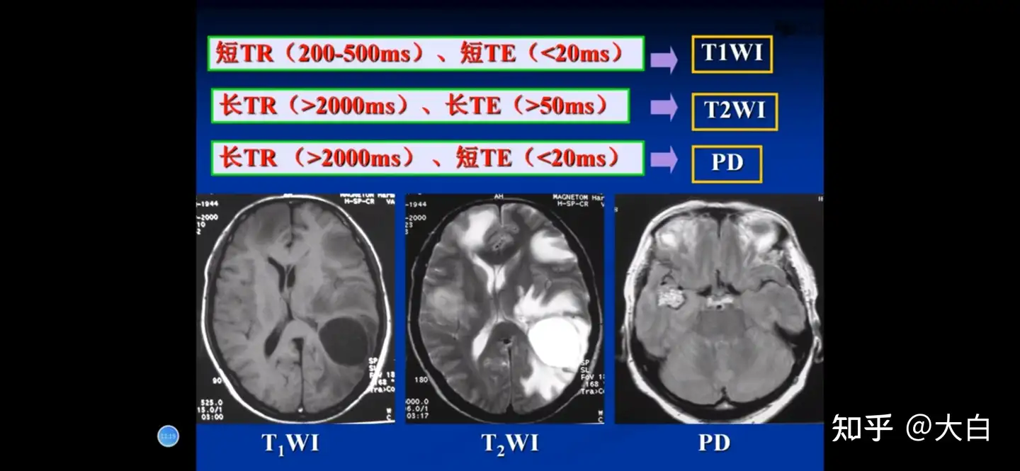 MRI基础知识- 知乎