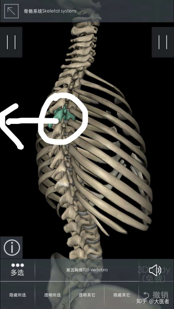 背部肌肉劳损能通过健身得到治愈吗?