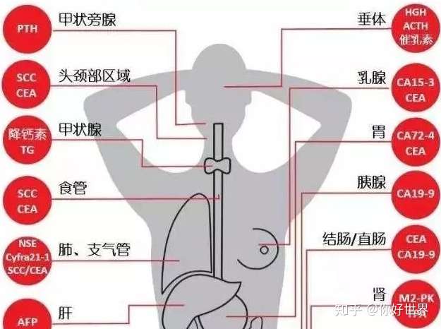 肿瘤标志物太多搞不清 肿瘤标志物这么 不靠谱 为什么还要去做 知乎