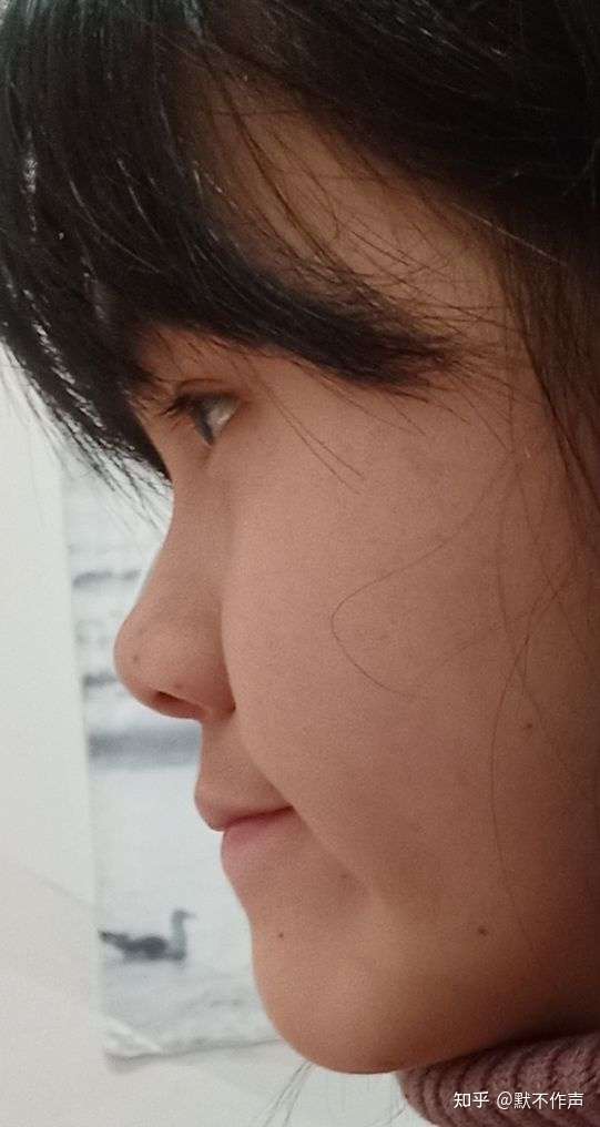 侧面巨丑正面好看是一种什么感受?