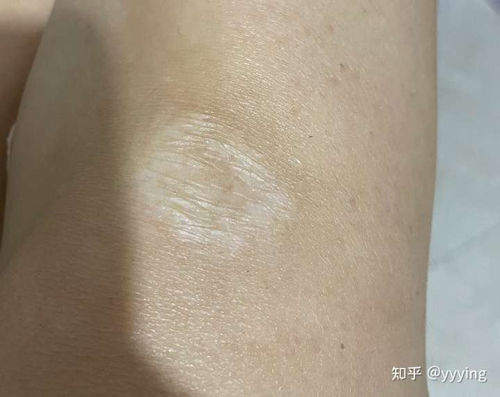 纹身纹肤色可以遮挡白色疤痕吗?