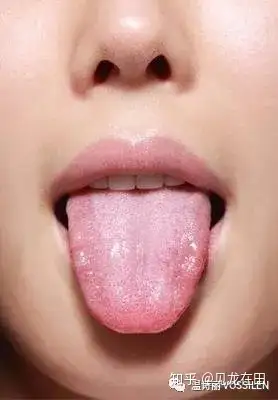 正常人的舌苔应该是薄白苔,如果体内出现问题,舌苔的厚薄就会发生变化