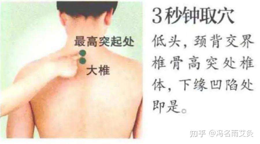 风湿 类风湿不用怕 这组穴位或许能帮到你 知乎