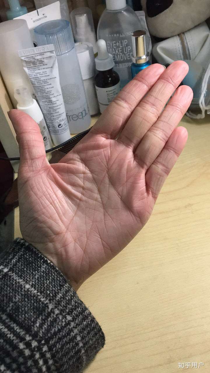 从小掌纹就很深很乱这是种病吗?