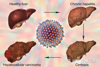 在這種情況下就會讓血液循環受到很大的影響