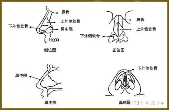 歪鼻整形不容小觑 专家告诉你 歪鼻整形应注意哪些 知乎