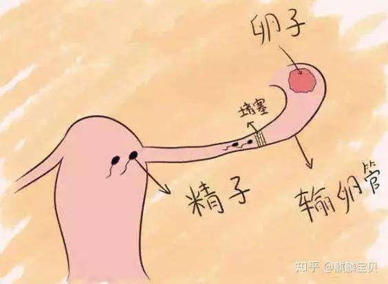 引发宫外孕,输卵管为何从来不讲武德?插图 v2-2bc76a92aac2f098a95b25f26105b9df_720w.jpg插图