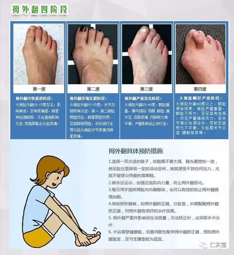 6种与痛风易混淆的病症 知乎