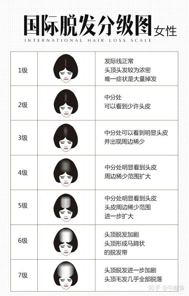 正确的护发方法防止洗头常掉发 知乎